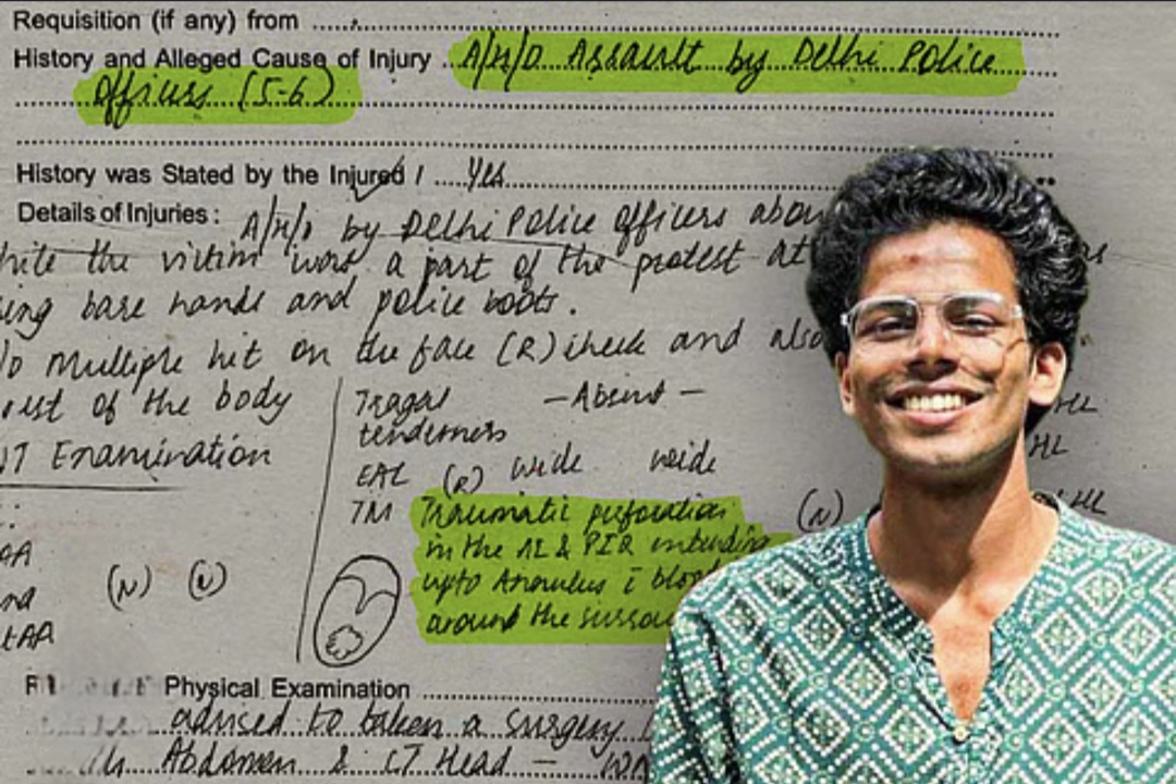 The Ear That Paid For Protest 