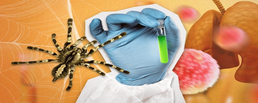 Spider Venom Fights Cancer